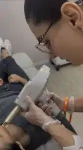 Laser Erbium Fracionado: Benefícios, Indicações e Como Funciona