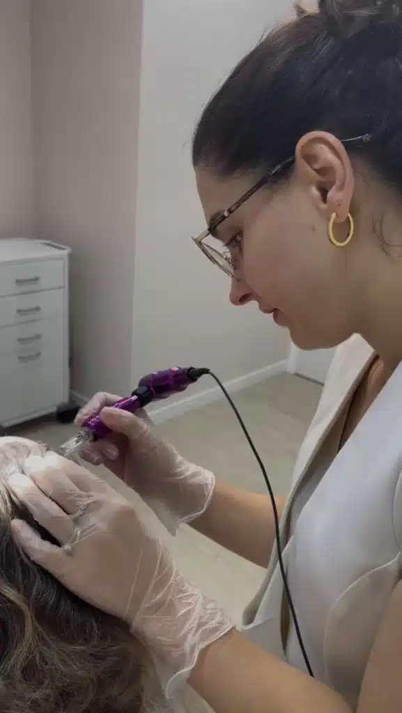 MMP Capilar: Tratamento Inovador para Queda de Cabelo