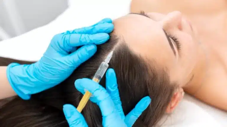 MMP Capilar: Tratamento Inovador para Queda de Cabelo