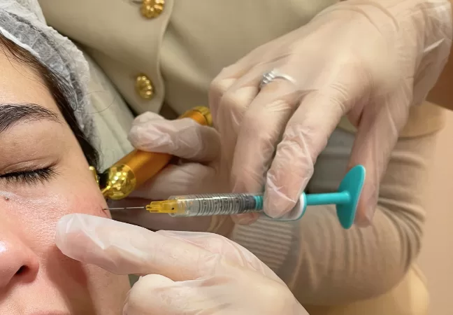 Blog - Dermatologista em Pinheiros 1 Preenchimento de Olheiras: Tudo o que Você Precisa Saber