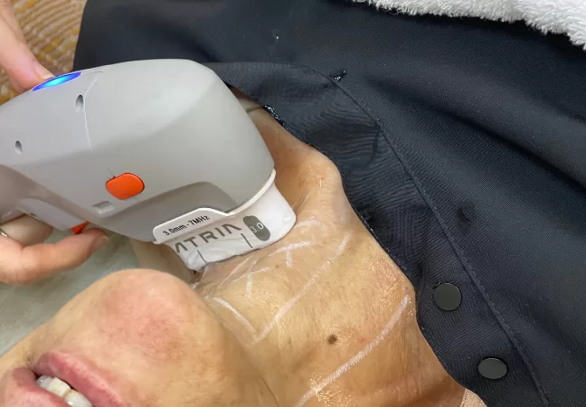 Ultrassom microfocado e macrofocado: conheça a tecnologia que estimula o colágeno e promove lifting facial e corporal sem cortes.